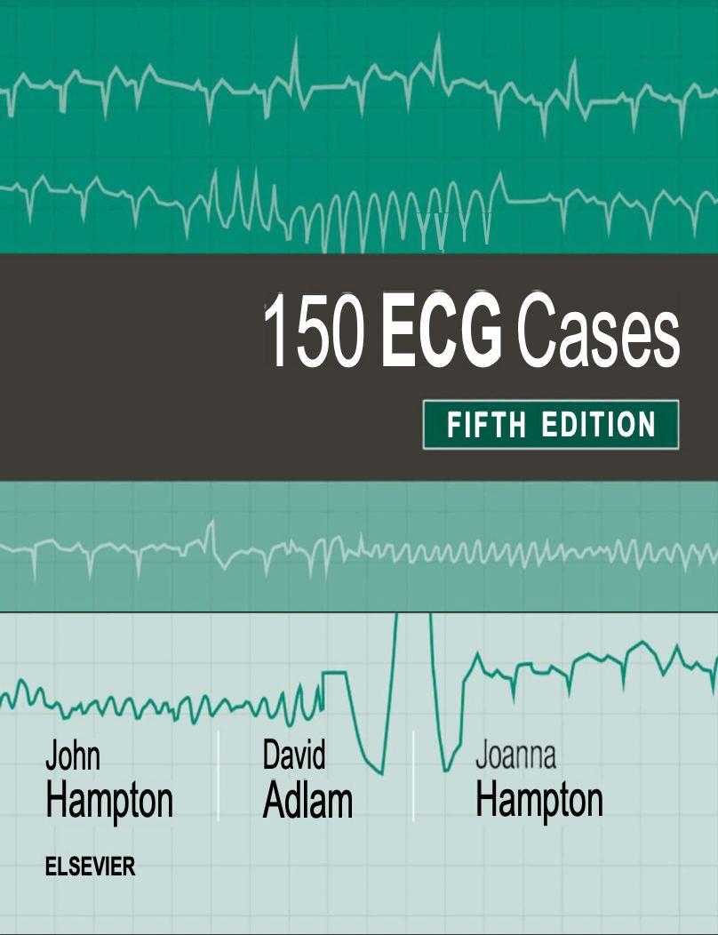 150 ECG Cases